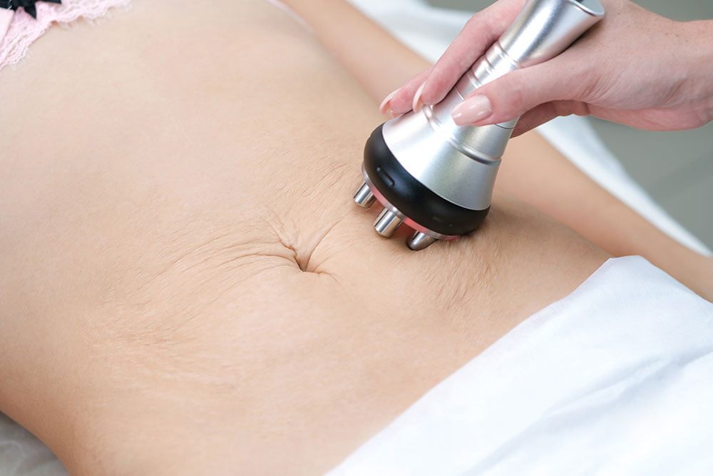 Body RF at Beauty & Shine, London SW8