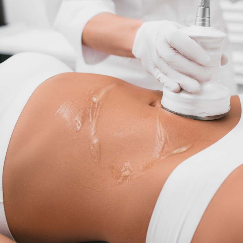 Cavitation at Beauty & Shine, London SW8