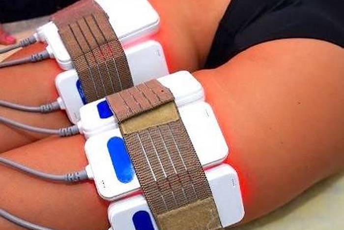 Laser Lipo at Beauty & Shine